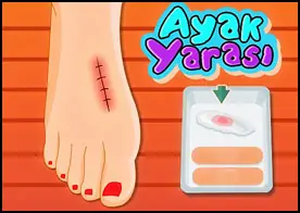 Ayak Yarası - Ayağı yaralanan Elsa'nın önce yarasını pansuman yapıp temizleyin tedavi ettikten sonra uygun kıyafet ve aksesuarları kullanıp yarayı gizleyin